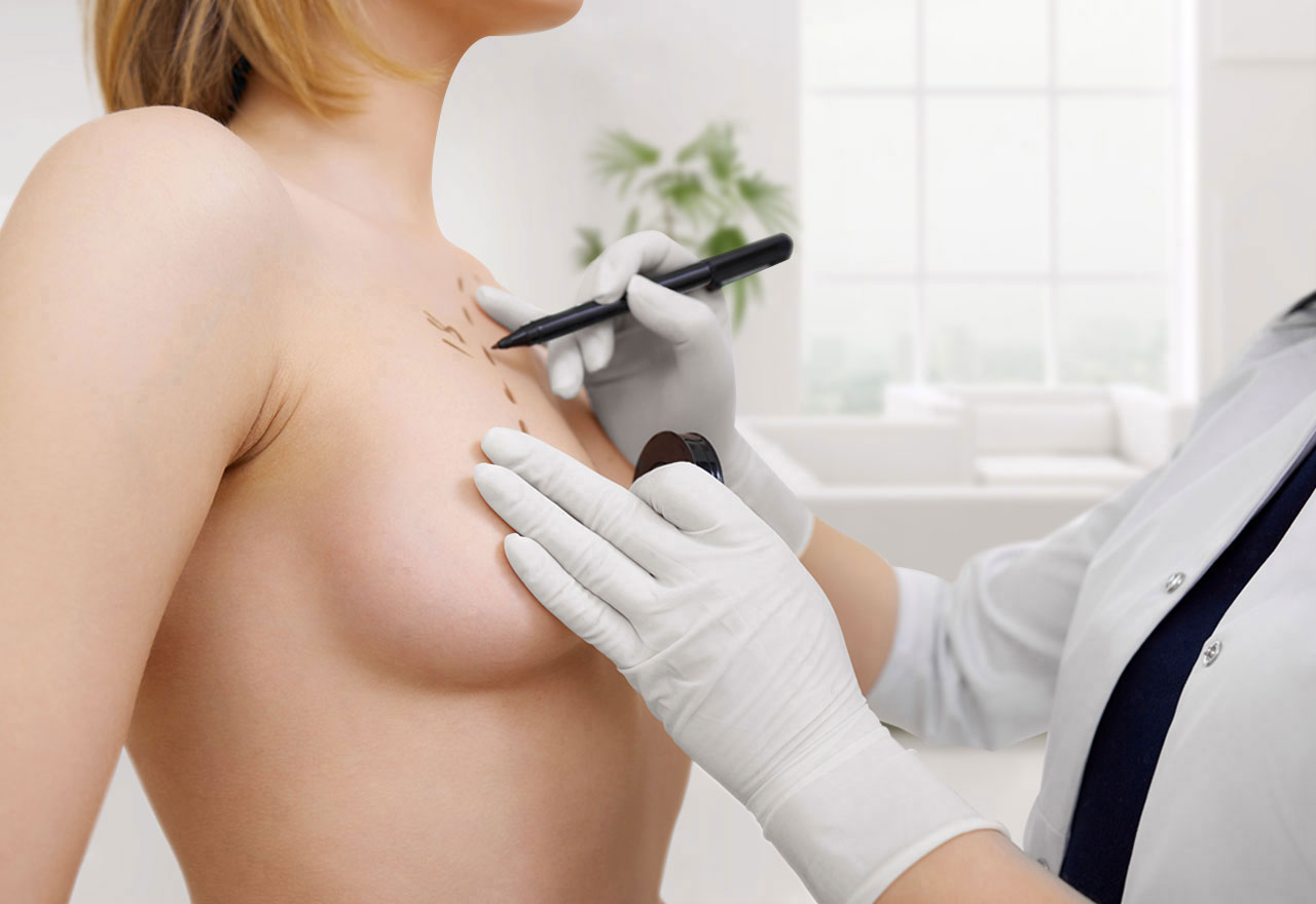 Breast Surgery istanbul