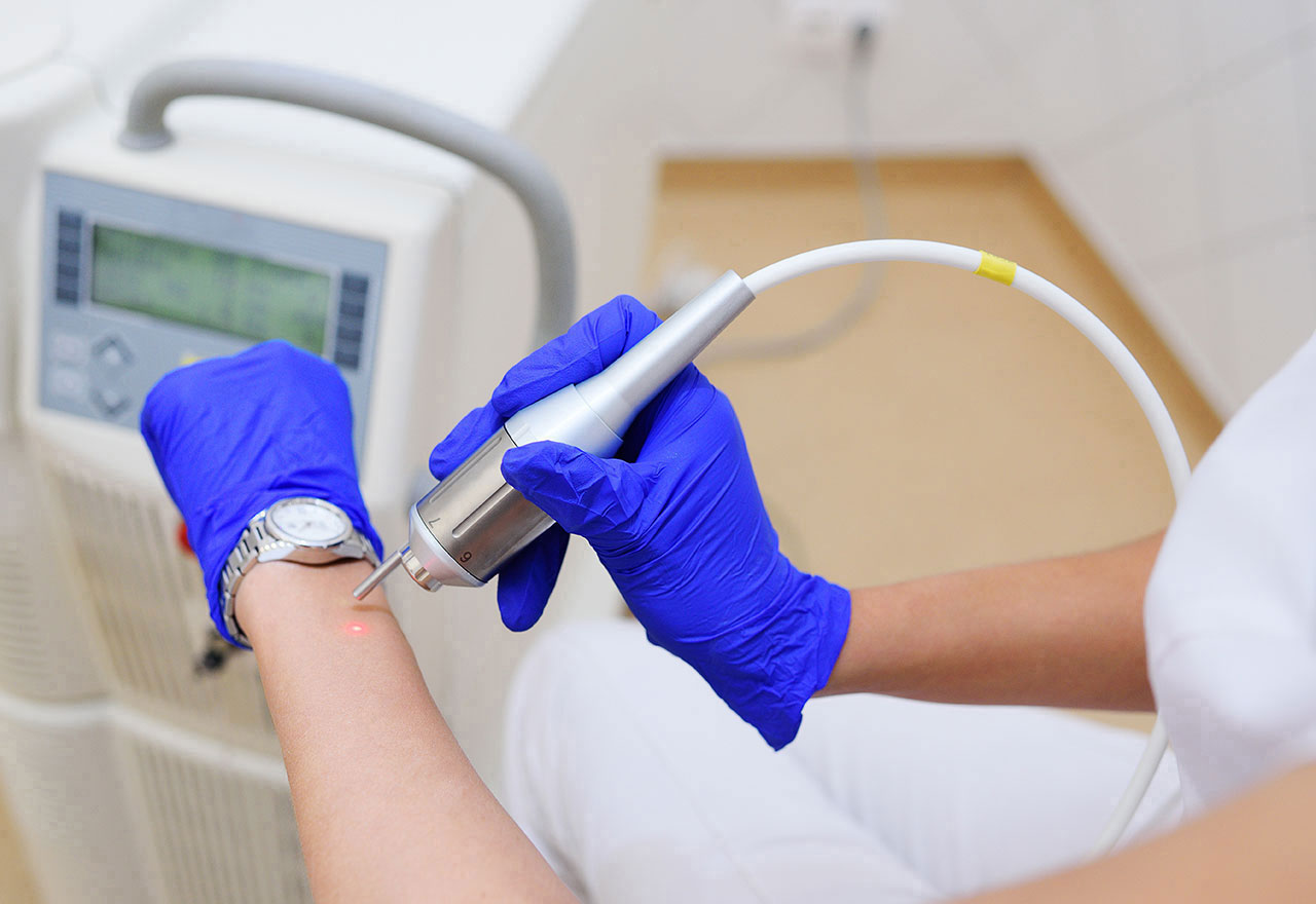 Eliminare Verruche Mani E Piedi Con Laserterapia - Centro Genesy Vicenza - Foto 2